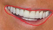 trump-teeth